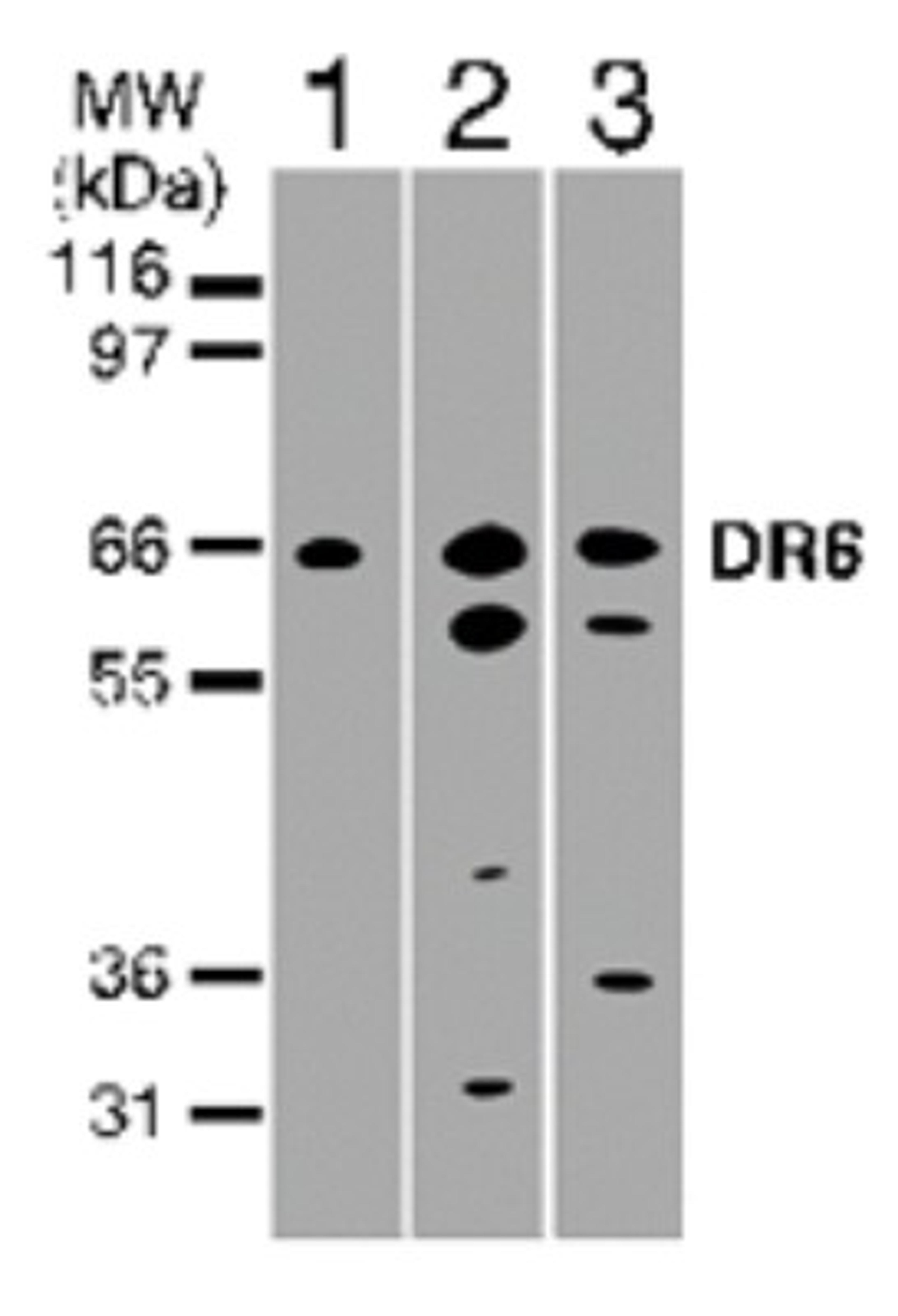 Western Blot: DR6 Antibody [NB600-1400] - Western blot analysis of 30 ug of total cell lysate from Jurkat (lane 1), HeLa (lane 2), and Daudi (lane 3) cells with NB600-1400 at 2 ug/ml.