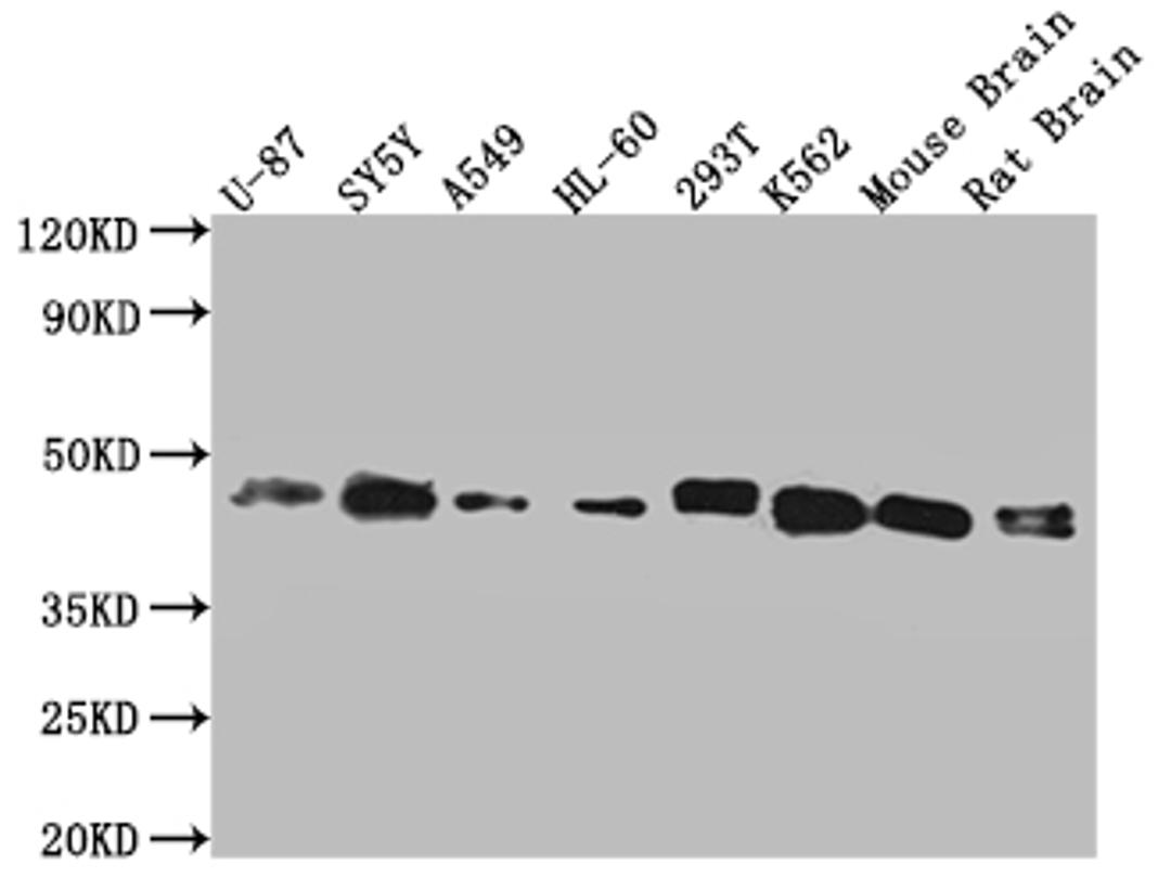 Western Blot. Positive WB detected in: Hela whole cell lysate, U87 whole cell lysate, SY5Y whole cell lysate, A549 whole cell lysate, HL-60 whole cell lysate, 293T whole cell lysate, K562 whole cell lysate, mouse brain tissue, rat brain tissue. All lanes: SPPL3 antibody at 1:2000. Secondary. Goat polyclonal to rabbit IgG at 1/50000 dilution. Predicted band size: 43, 19 kDa. Observed band size: 43 kDa. 