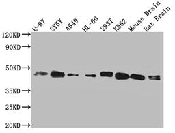 Western Blot. Positive WB detected in: Hela whole cell lysate, U87 whole cell lysate, SY5Y whole cell lysate, A549 whole cell lysate, HL-60 whole cell lysate, 293T whole cell lysate, K562 whole cell lysate, mouse brain tissue, rat brain tissue. All lanes: SPPL3 antibody at 1:2000. Secondary. Goat polyclonal to rabbit IgG at 1/50000 dilution. Predicted band size: 43, 19 kDa. Observed band size: 43 kDa. 