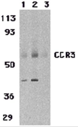 Western blot analysis of CCR3 in human spleen tissue lysates with CCR3 antibody at 1 (lane 1) and 2 μg/mL (lane 2), and 2 μg/mL in the presence of blocking peptide (lane 3).