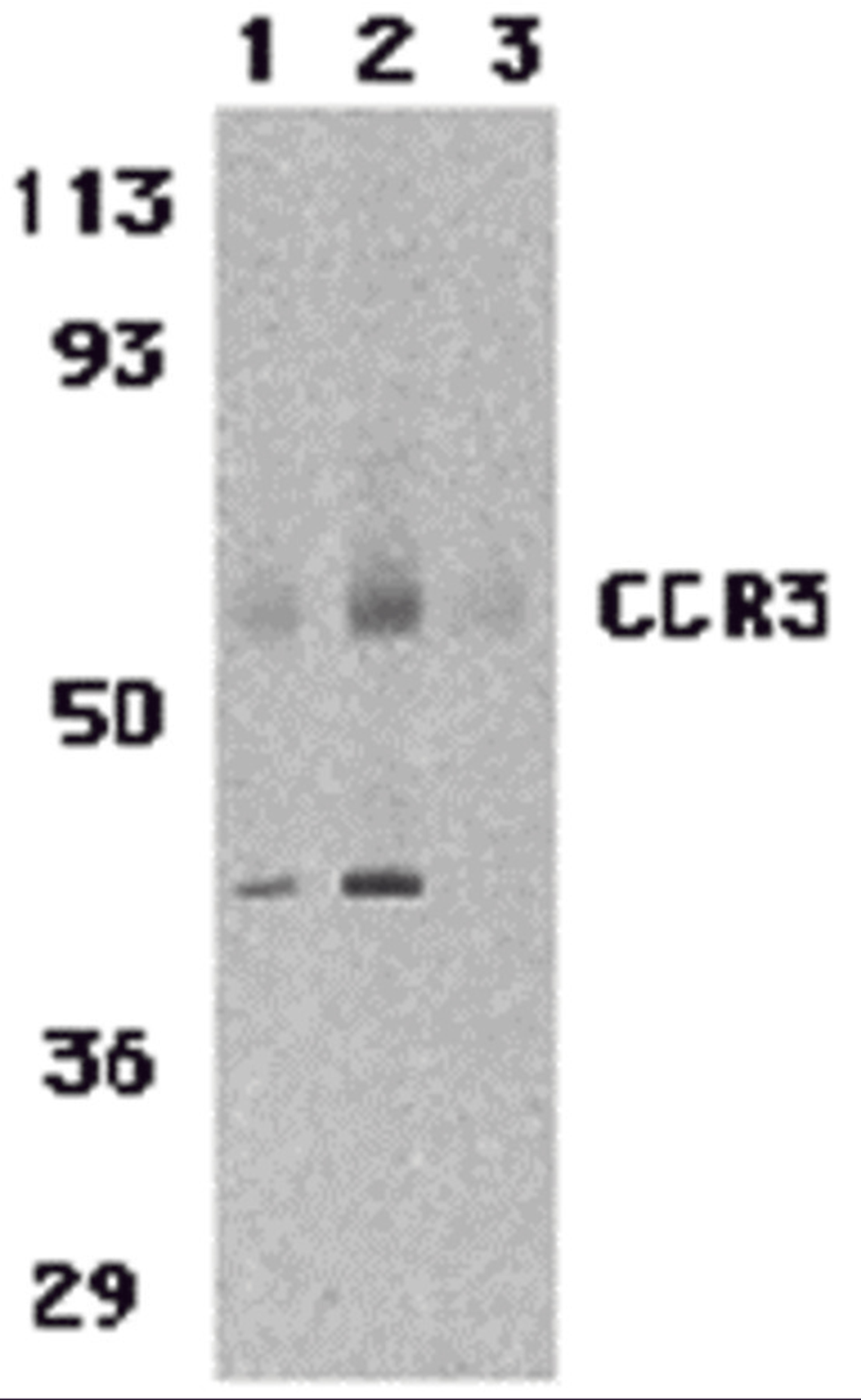 Western blot analysis of CCR3 in human spleen tissue lysates with CCR3 antibody at 1 (lane 1) and 2 μg/mL (lane 2), and 2 μg/mL in the presence of blocking peptide (lane 3).