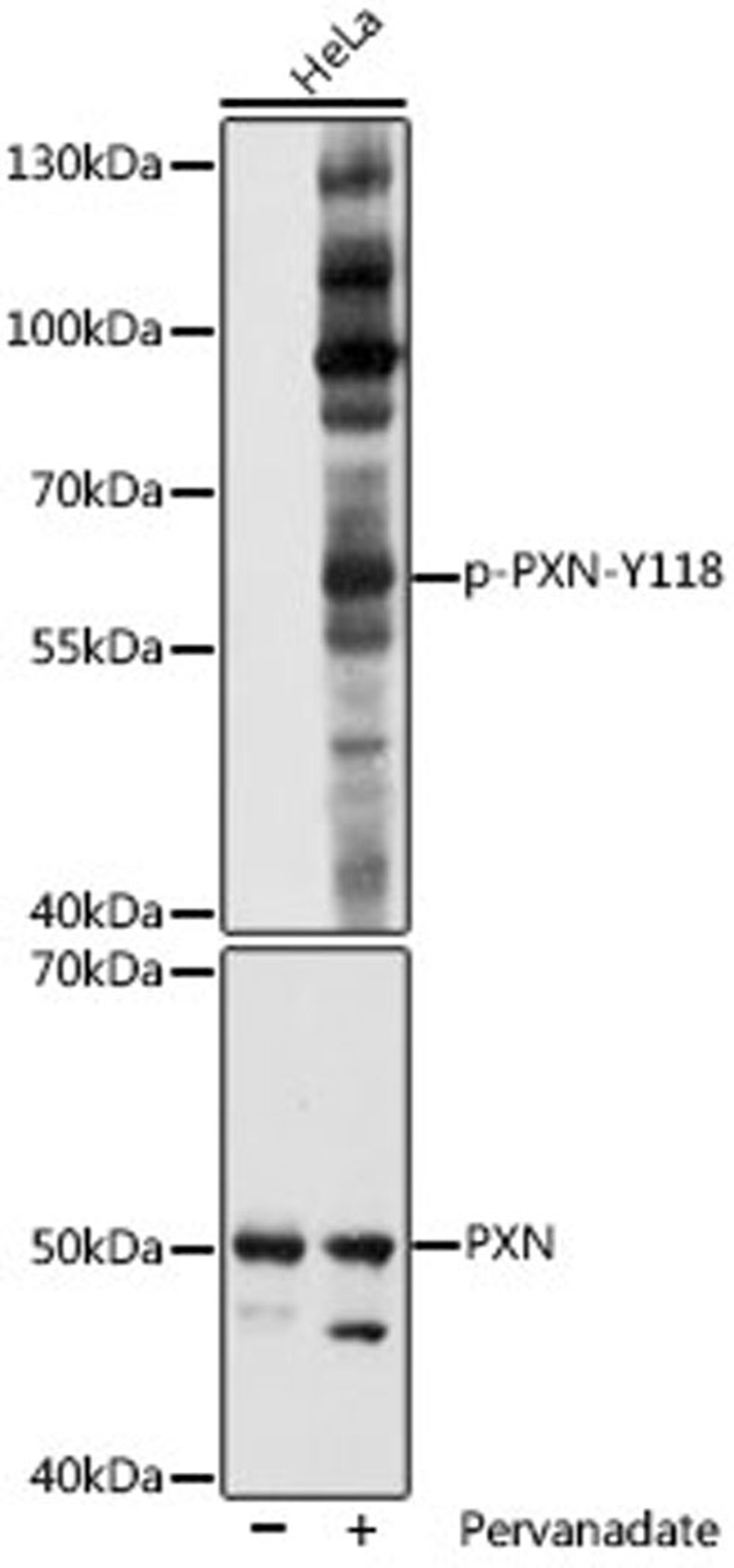 Western blot - Phospho-PXN-Y118 pAb (AP1057)