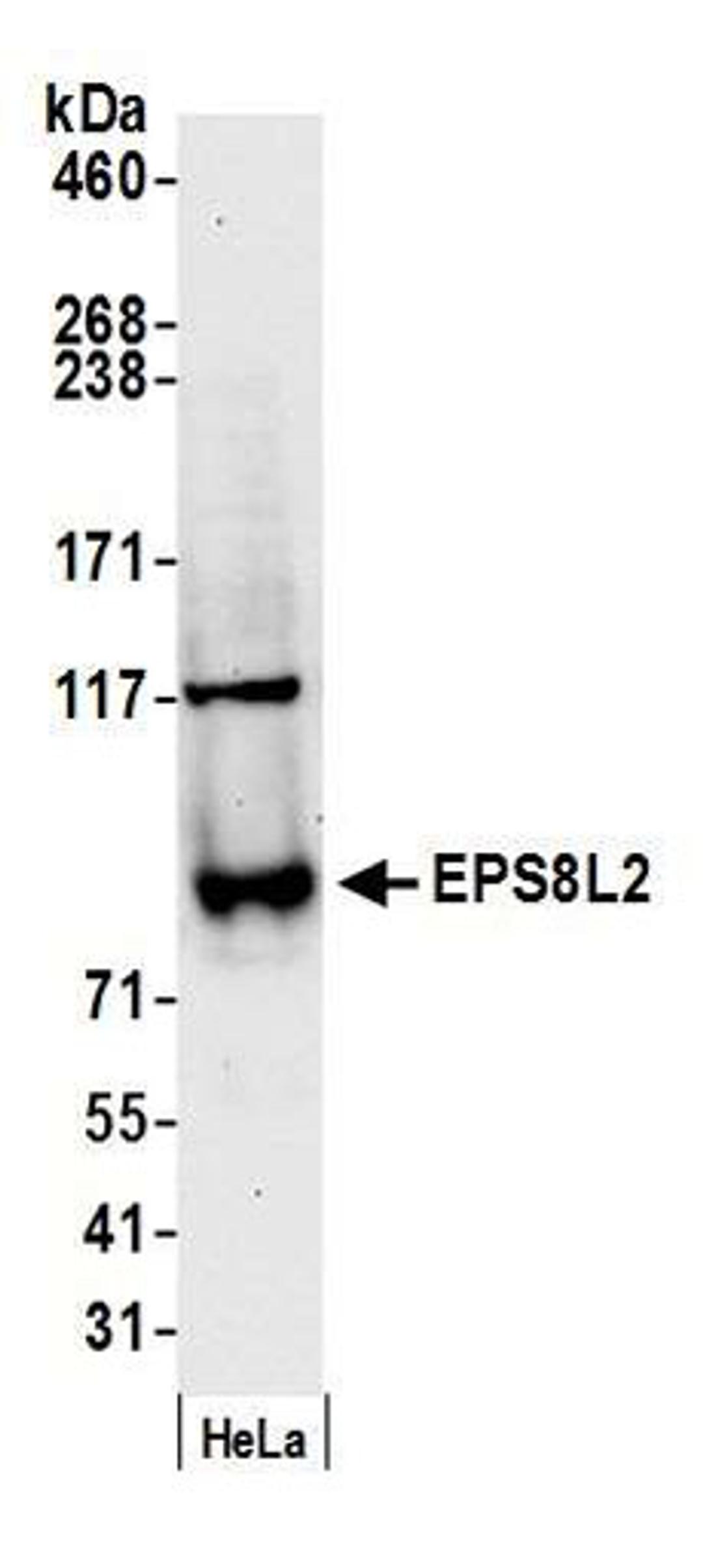 Detection of human EPS8L2 by western blot.