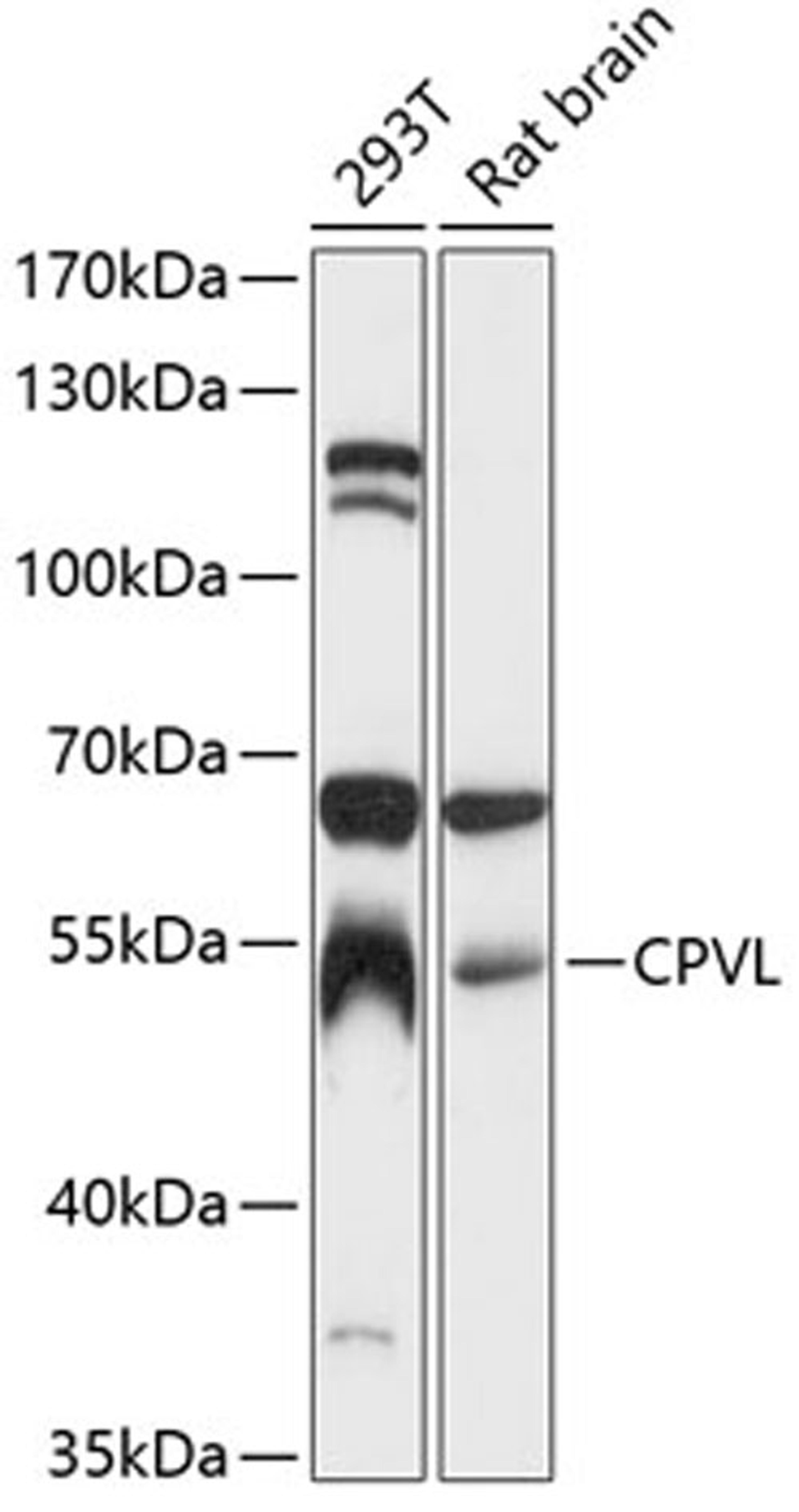 Western blot - CPVL antibody (A12370)