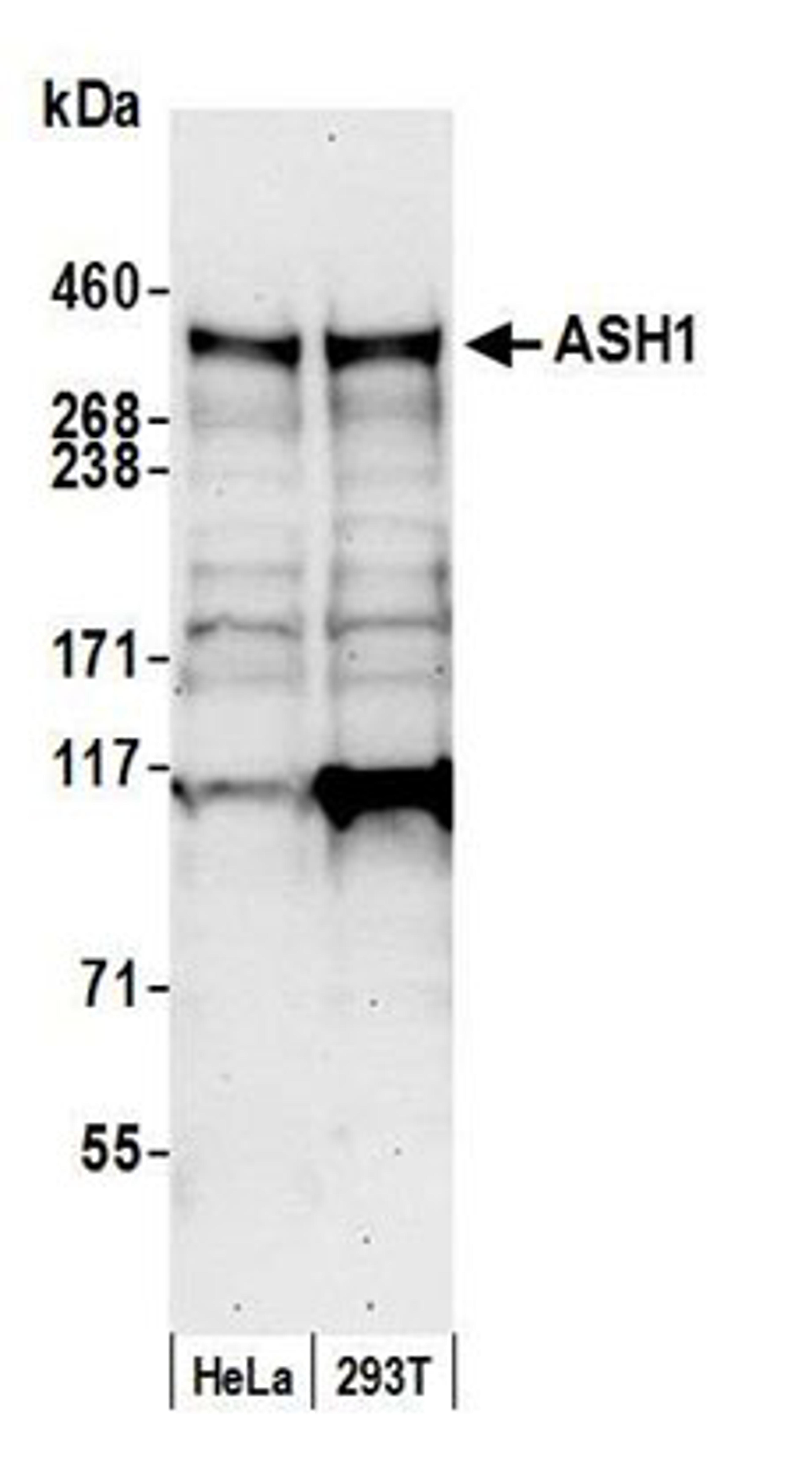 Detection of human ASH1 by western blot.