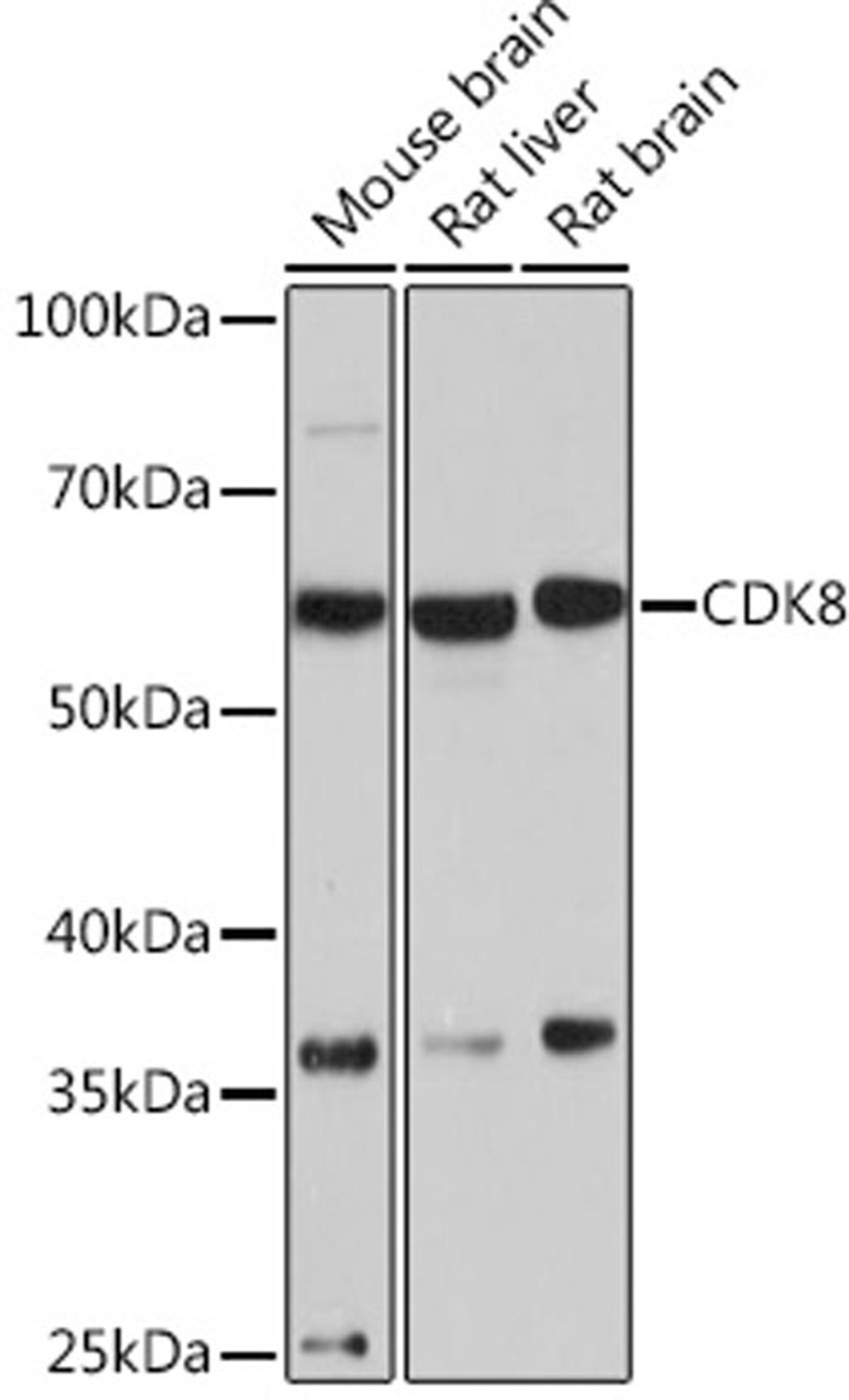 Western blot - CDK8 Rabbit mAb (A9654)