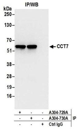 Detection of human CCT7 by western blot of immunoprecipitates.