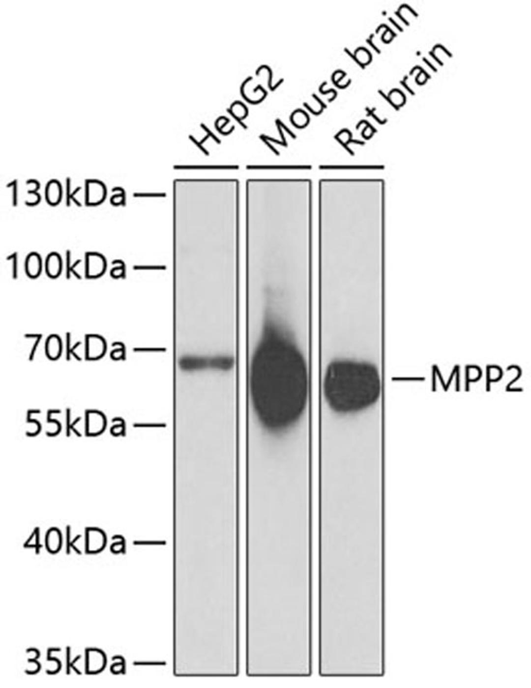 Western blot - MPP2 antibody (A6659)