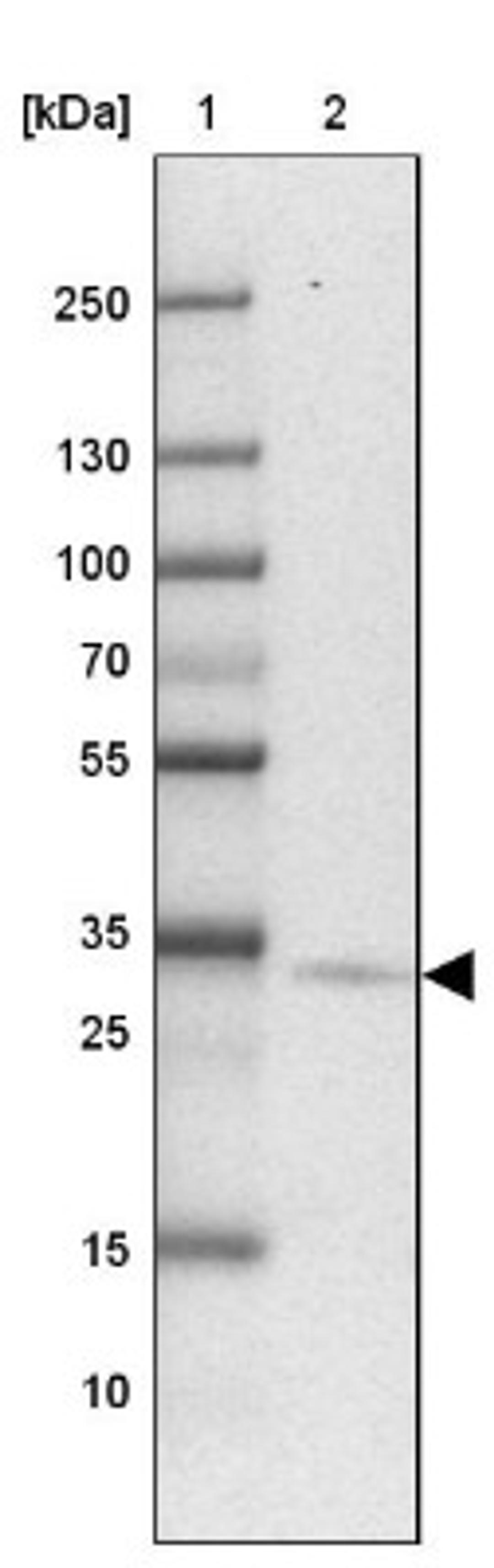 Western Blot: PTPLAD2 Antibody [NBP2-31725] - Lane 1: Marker [kDa] 250, 130, 100, 70, 55, 35, 25, 15, 10<br/>Lane 2: Lung