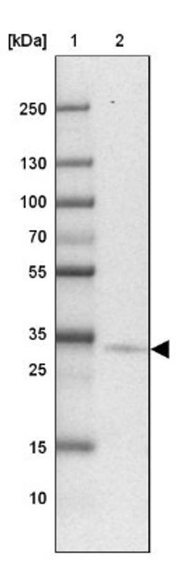 Western Blot: PTPLAD2 Antibody [NBP2-31725] - Lane 1: Marker [kDa] 250, 130, 100, 70, 55, 35, 25, 15, 10<br/>Lane 2: Lung