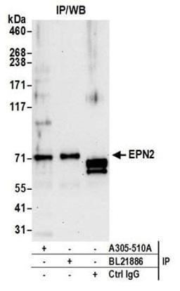 Detection of human EPN2 by western blot of immunoprecipitates.