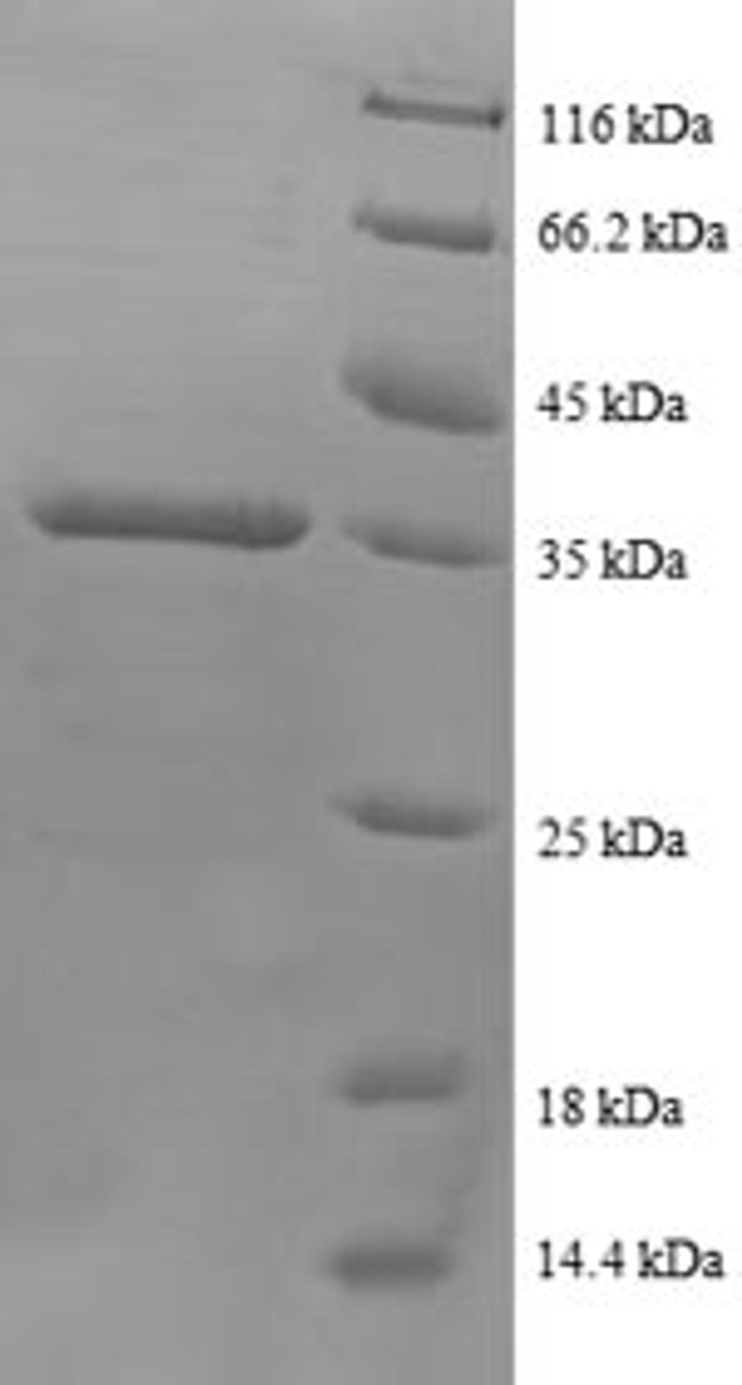 (Tris-Glycine gel) Discontinuous SDS-PAGE (reduced) with 5% enrichment gel and 15% separation gel.