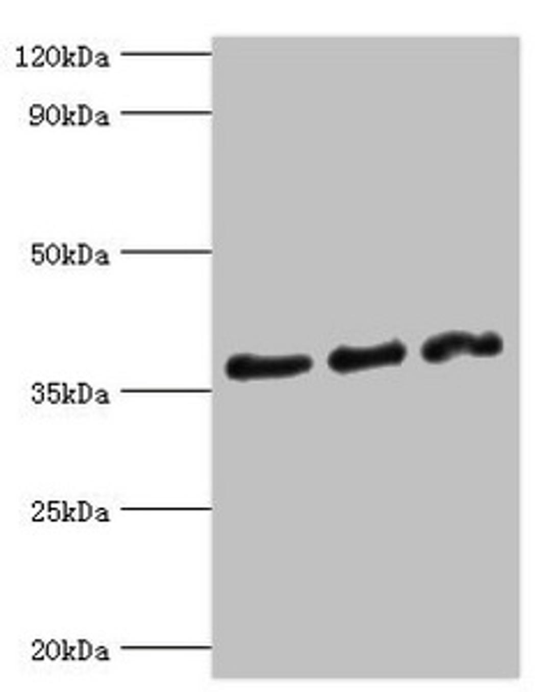 Western blot. All lanes: DFFA antibody at 10ug/ml. Lane 1: Hela whole cell lysate. Lane 2: 293T whole cell lysate. Lane 3: PC-3 whole cell lysate. Secondary. Goat polyclonal to rabbit IgG at 1/10000 dilution. Predicted band size: 37, 30 kDa. Observed band size: 37 kDa. 