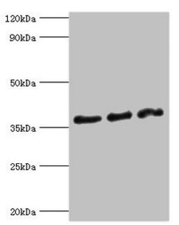 Western blot. All lanes: DFFA antibody at 10ug/ml. Lane 1: Hela whole cell lysate. Lane 2: 293T whole cell lysate. Lane 3: PC-3 whole cell lysate. Secondary. Goat polyclonal to rabbit IgG at 1/10000 dilution. Predicted band size: 37, 30 kDa. Observed band size: 37 kDa. 