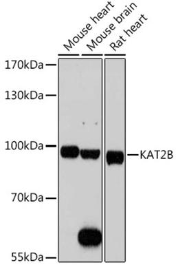 Western blot - KAT2B antibody (A0066)