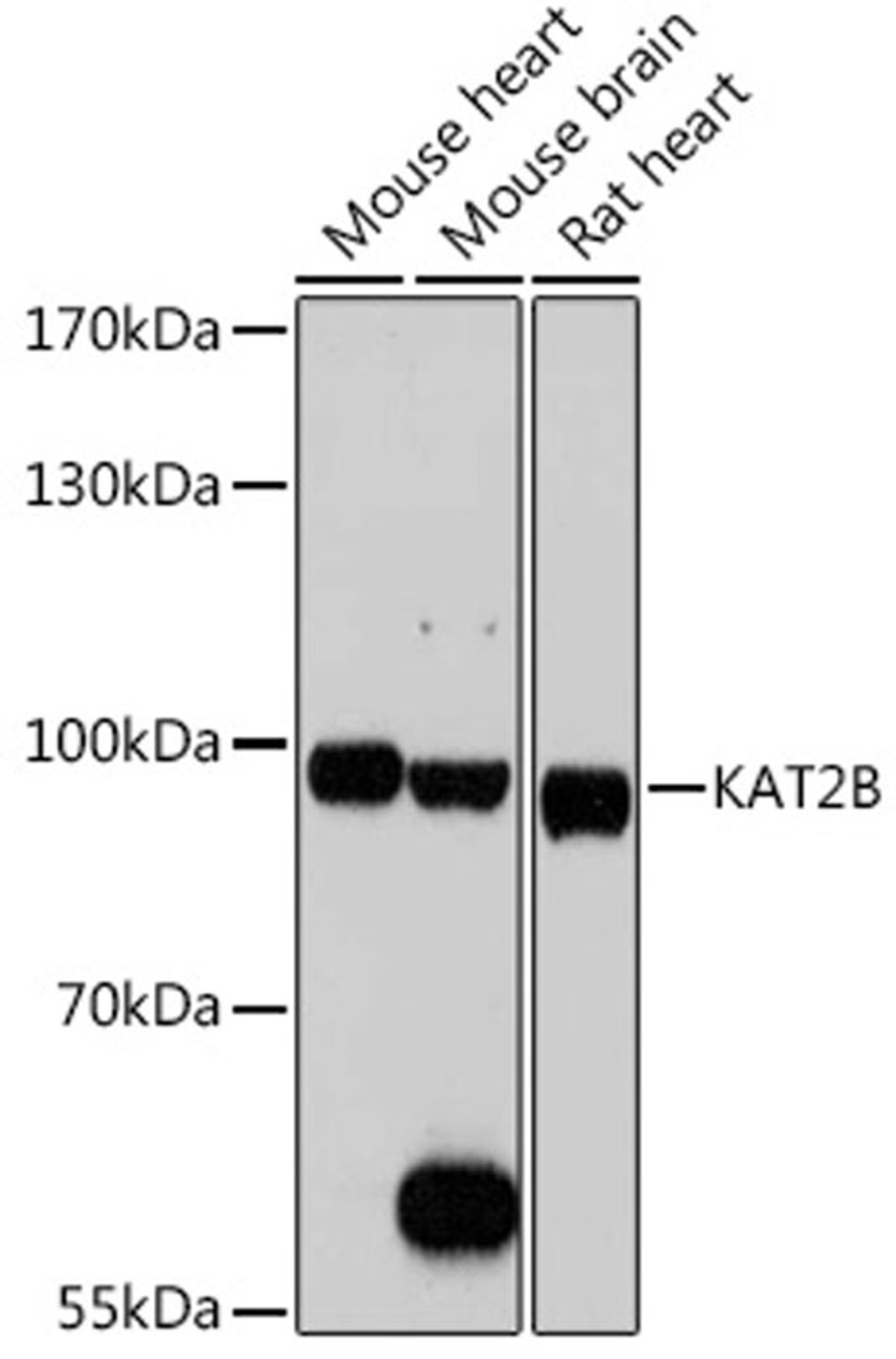 Western blot - KAT2B antibody (A0066)