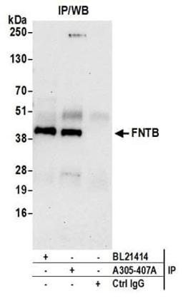 Detection of human FNTB by western blot of immunoprecipitates.