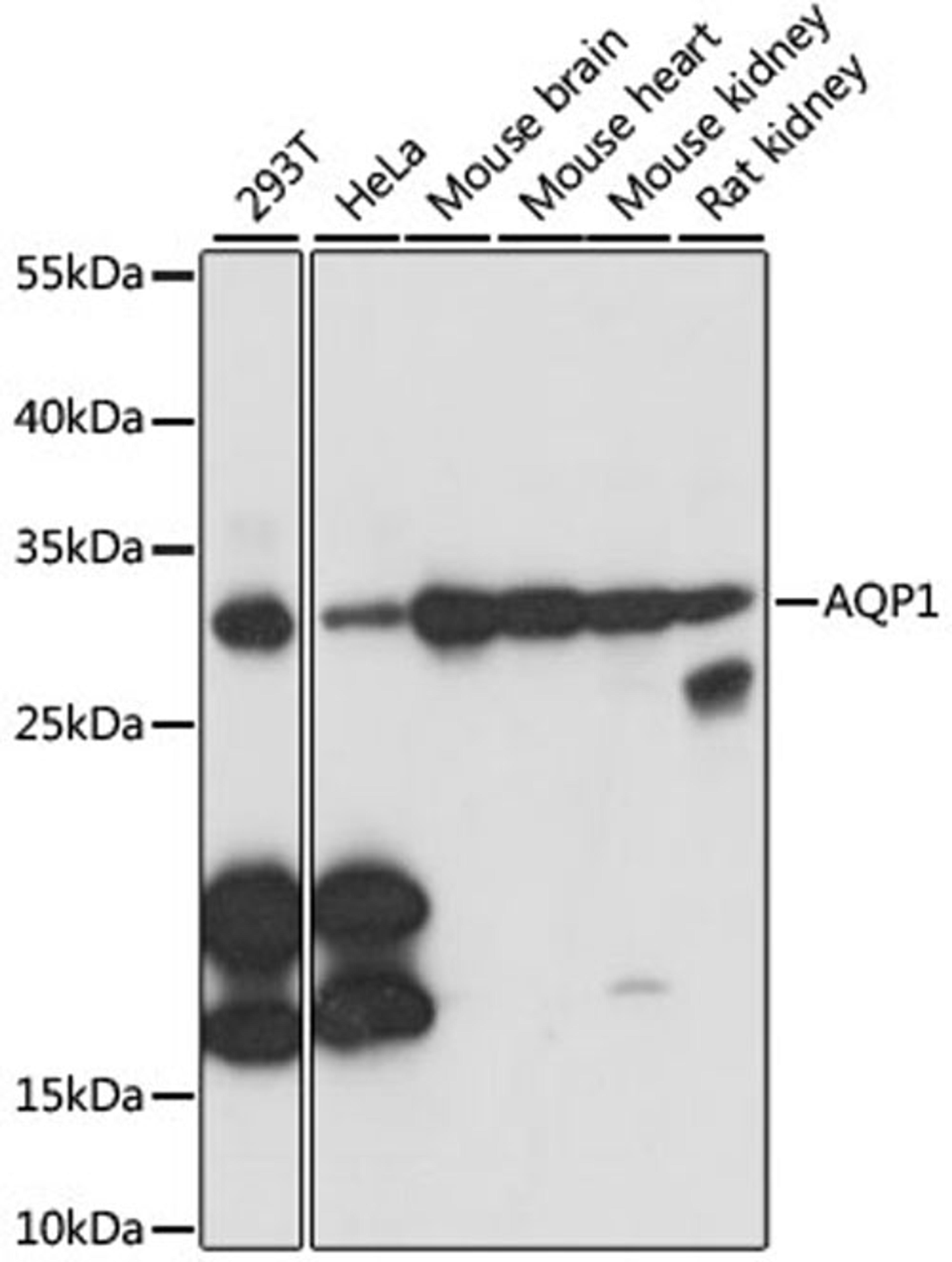 Western blot - AQP1 antibody (A15030)