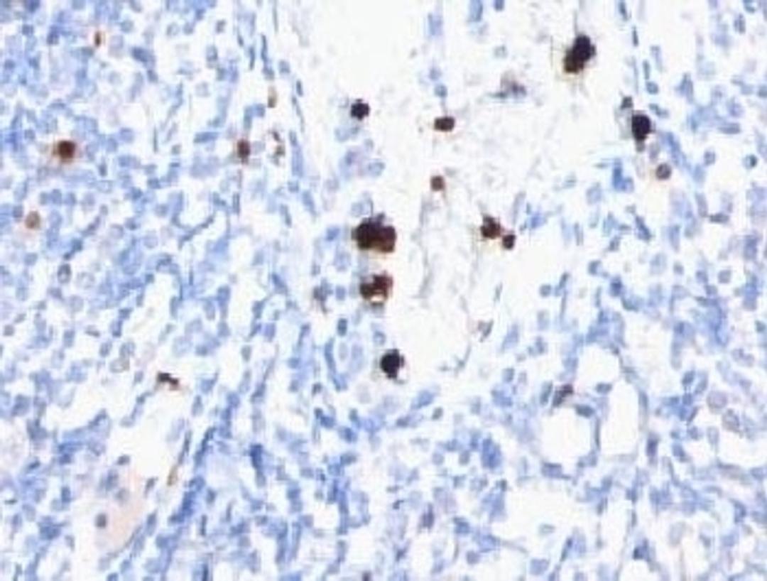 IHC testing of FFPE human tonsil with MYDAM antibody (clone MYUP1).