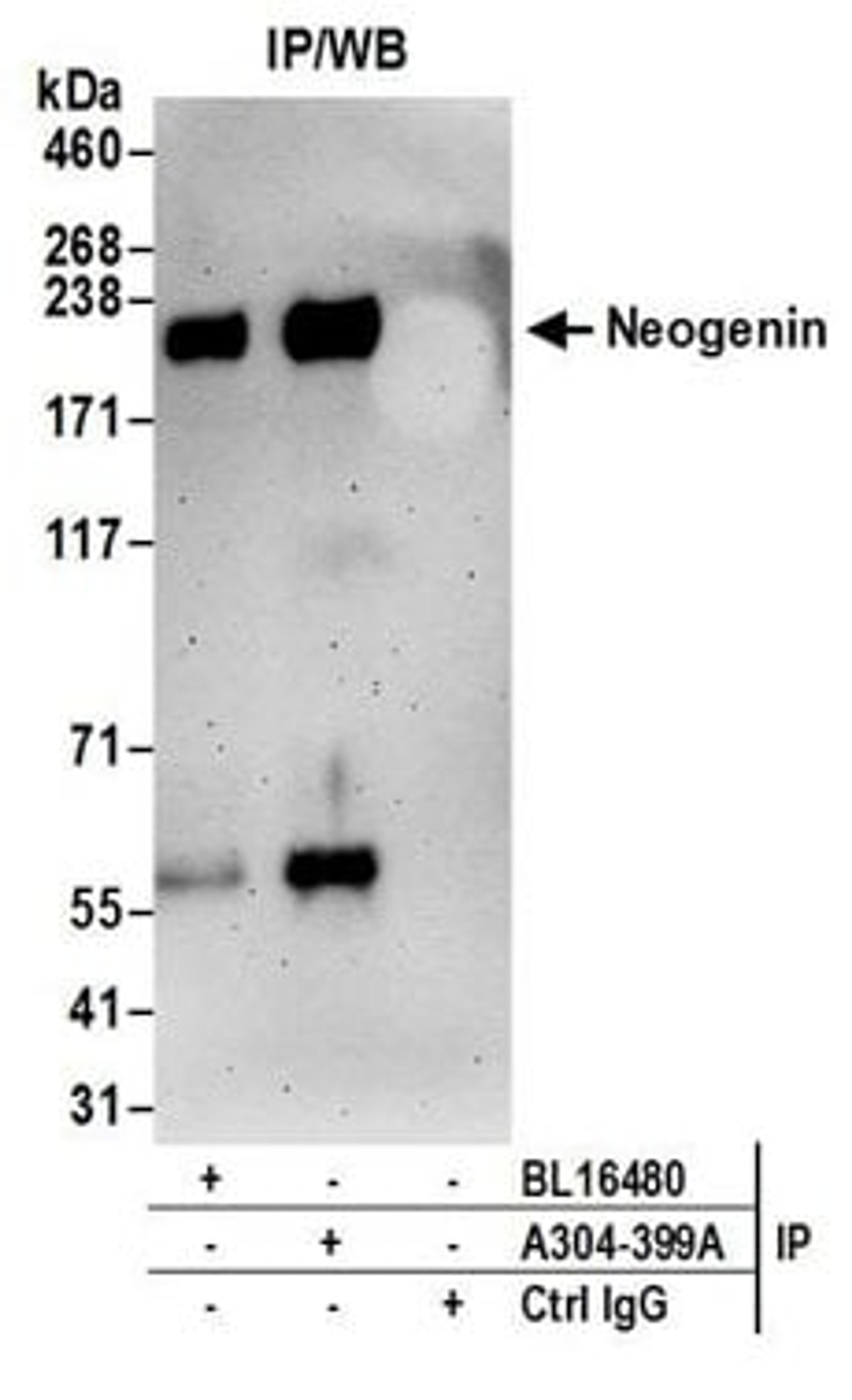 Detection of human Neogenin by western blot of immunoprecipitates.