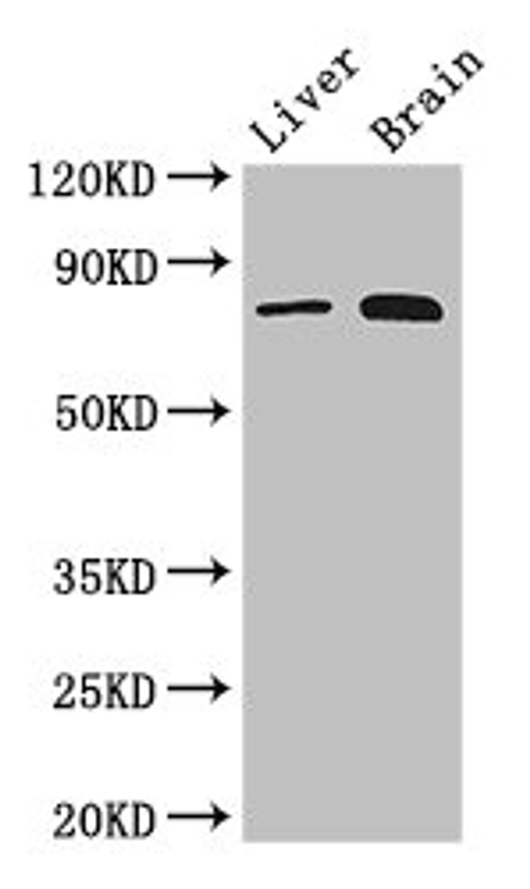 Western Blot. Positive WB detected in: Mouse liver tissue, Mouse brain tissue. All lanes: TBK1 antibody at 3ug/ml. Secondary. Goat polyclonal to rabbit IgG at 1/50000 dilution. Predicted band size: 84 kDa. Observed band size: 84 kDa.