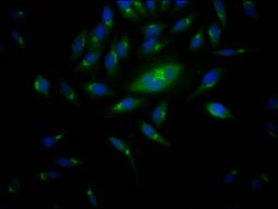 Immunofluorescence staining of Hela Cells with CSB-RA299200A0HU at 1:50, counter-stained with DAPI. The cells were fixed in 4% formaldehyde, permeated by 0.2% TritonX-100, and blocked in 10% normal Goat Serum. The cells were then incubated with the antibody overnight at 4℃. Nuclear DNA was labeled in blue with DAPI. The secondary antibody was FITC-conjugated AffiniPure Goat Anti-Rabbit IgG (H+L).