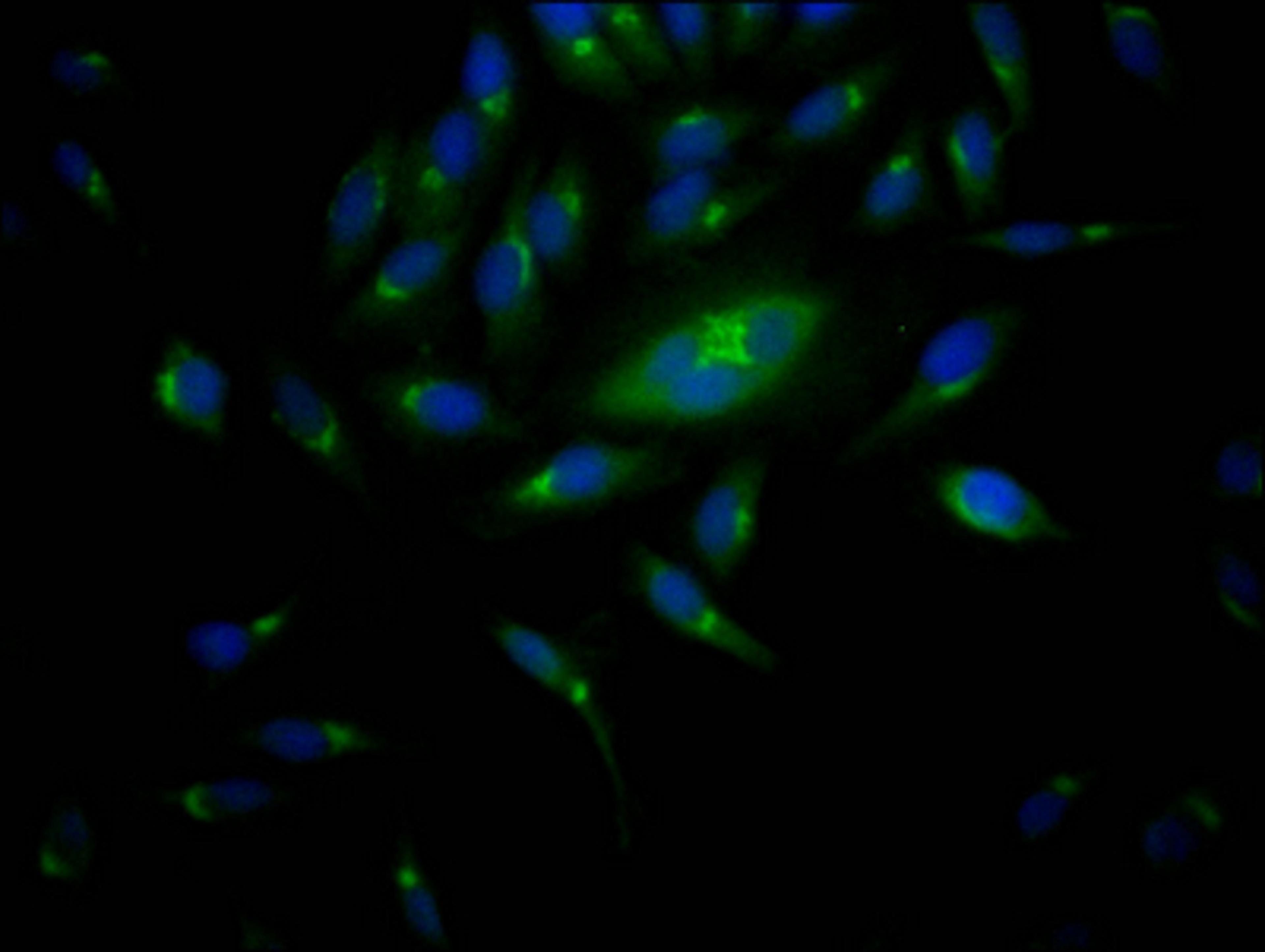 Immunofluorescence staining of Hela Cells with CSB-RA299200A0HU at 1:50, counter-stained with DAPI. The cells were fixed in 4% formaldehyde, permeated by 0.2% TritonX-100, and blocked in 10% normal Goat Serum. The cells were then incubated with the antibody overnight at 4℃. Nuclear DNA was labeled in blue with DAPI. The secondary antibody was FITC-conjugated AffiniPure Goat Anti-Rabbit IgG (H+L).