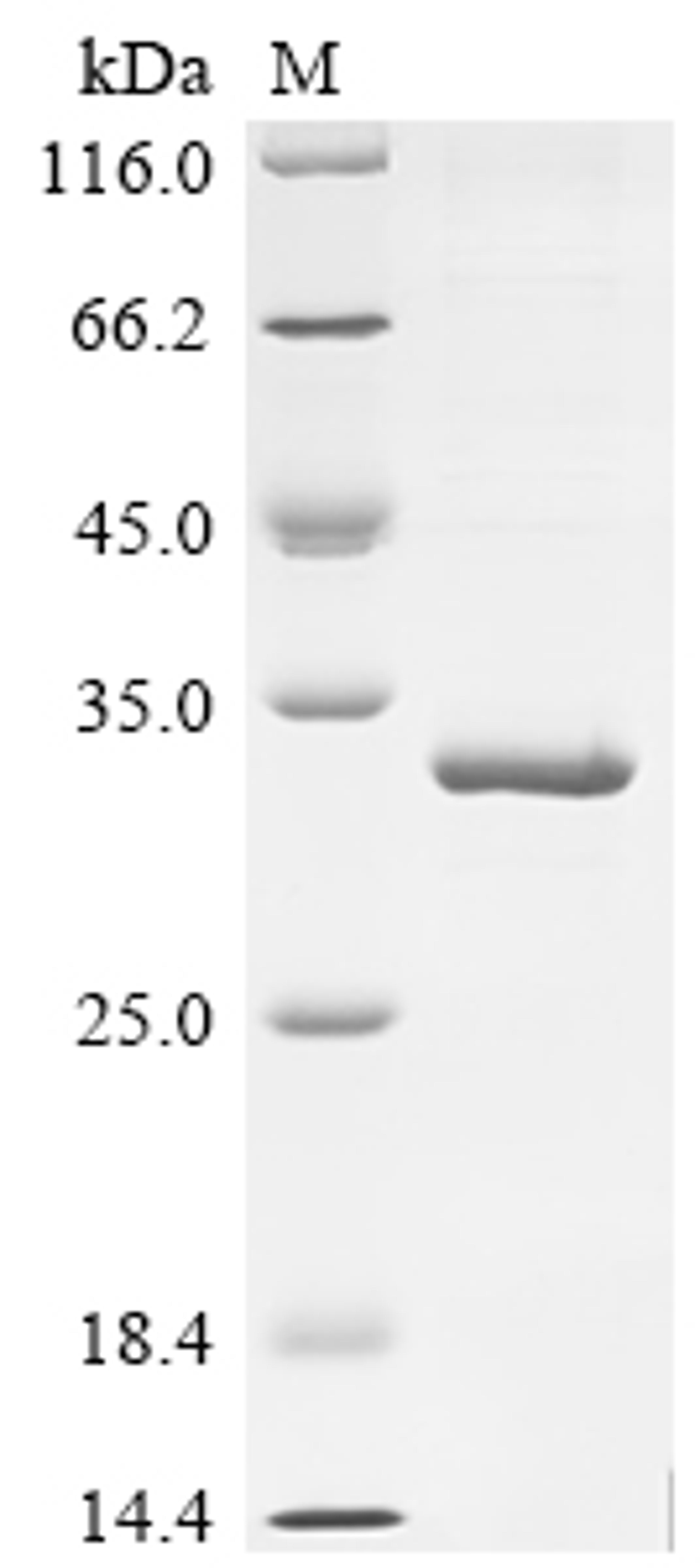 (Tris-Glycine gel) Discontinuous SDS-PAGE (reduced) with 5% enrichment gel and 15% separation gel.