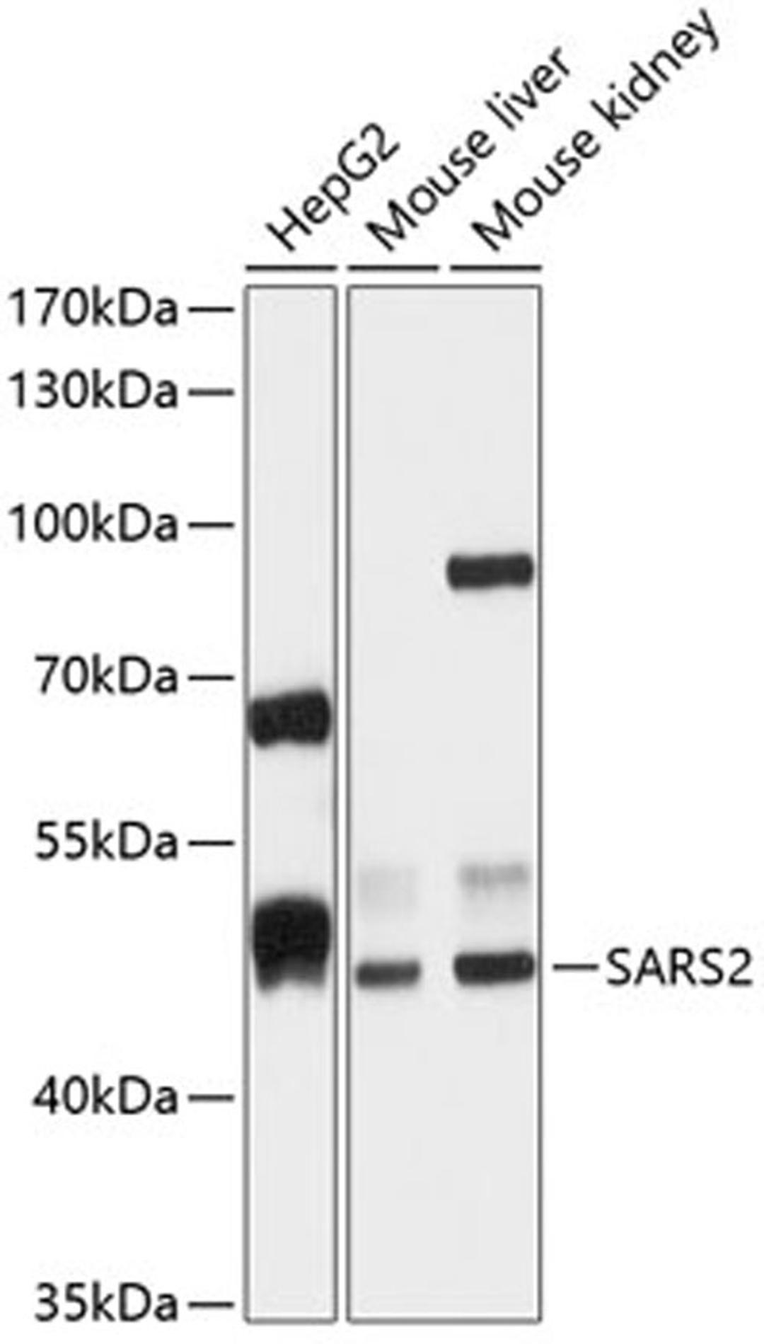 Western blot - SARS2 antibody (A12297)