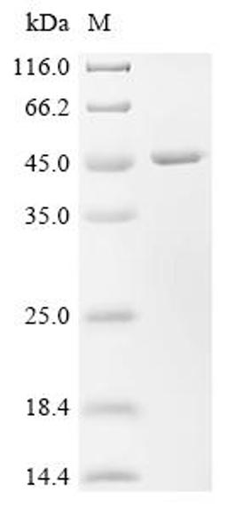 (Tris-Glycine gel) Discontinuous SDS-PAGE (reduced) with 5% enrichment gel and 15% separation gel.