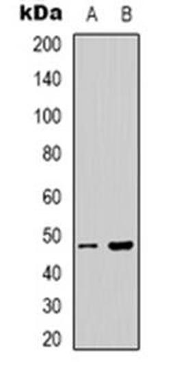 Western blot analysis of PSKH1 expression in Hela (Lane 1), HepG2 (Lane 2) whole cell lysates using PSKH1 antibody