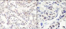 Detection of human and mouse HMG2a by immunohistochemistry.