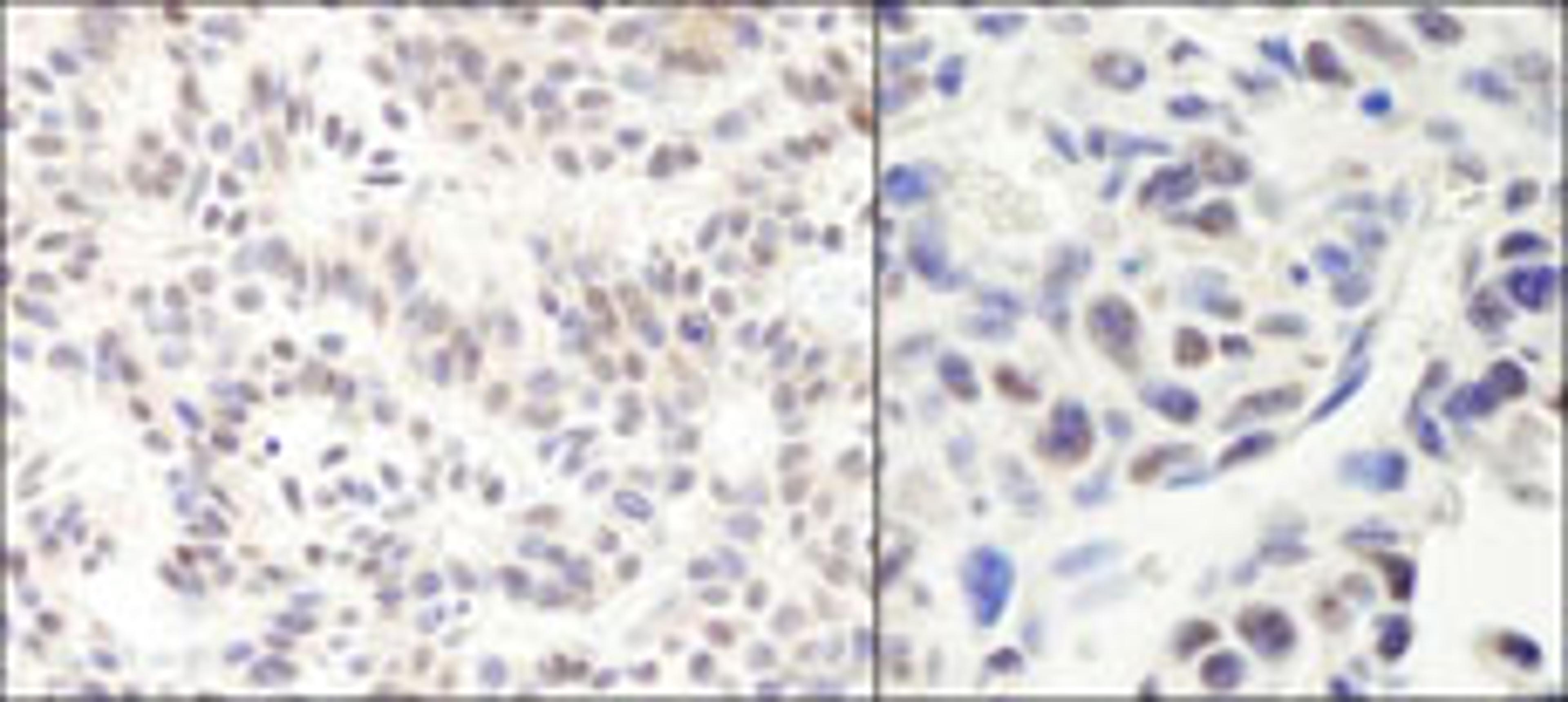 Detection of human and mouse HMG2a by immunohistochemistry.