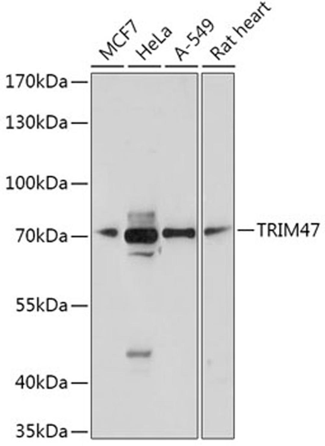 Western blot - TRIM47 antibody (A17803)