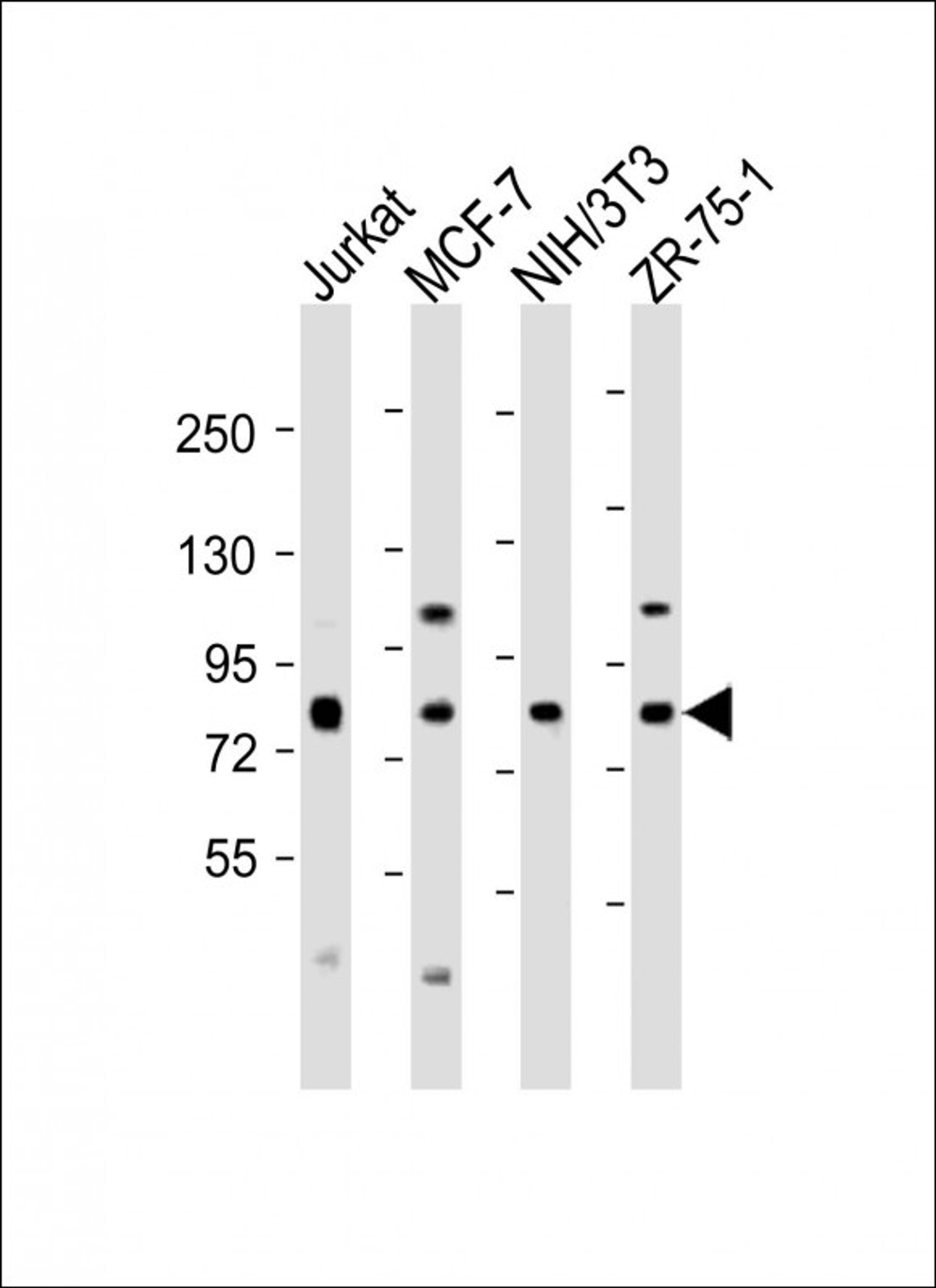 Western Blot at 1:2000 dilution Lane 1: Jurkat whole cell lysate Lane 2: MCF-7 whole cell lysate Lane 3: NIH/3T3 whole cell lysate Lane 4: ZR-75-1 whole cell lysate Lysates/proteins at 20 ug per lane.