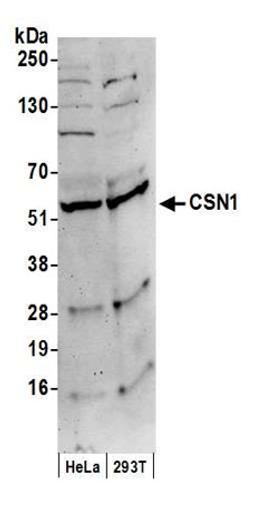 Detection of human CSN1 by western blot.