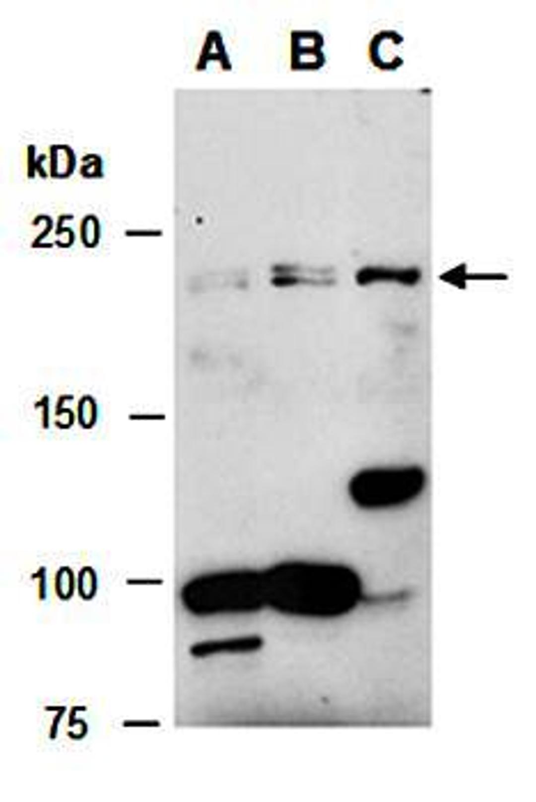 Western blot analysis of total cell extracts from human iPS(Lane1),human Jurkat(Lane2) and mouse thymus(Lane3) using TET1 antibody