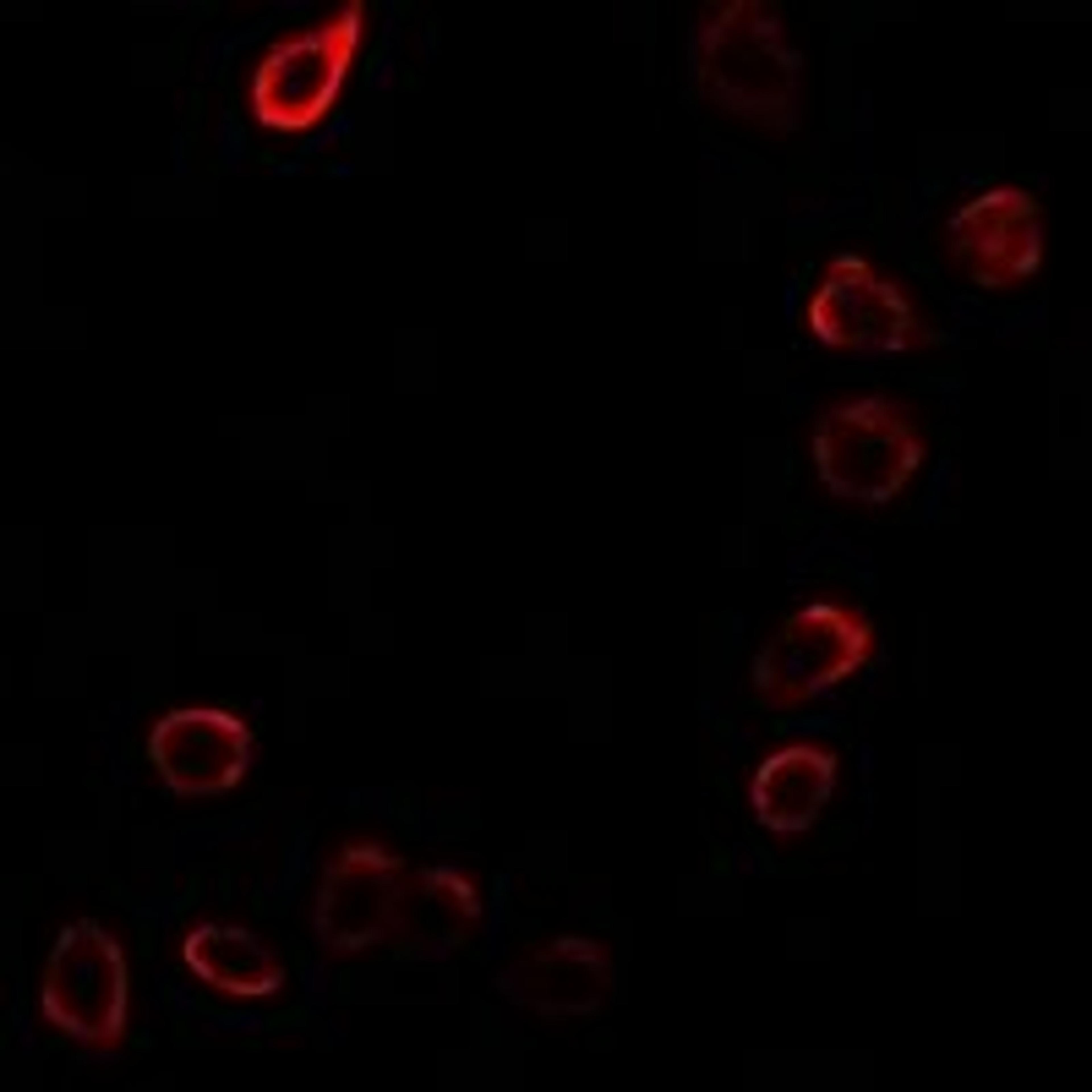 Immunofluorescent analysis of MCF7 cells using CDKN3 antibody