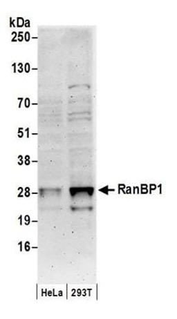 Detection of human RanBP1 by western blot.