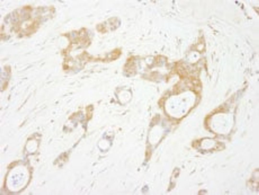 Detection of human OSR1 by immunohistochemistry.