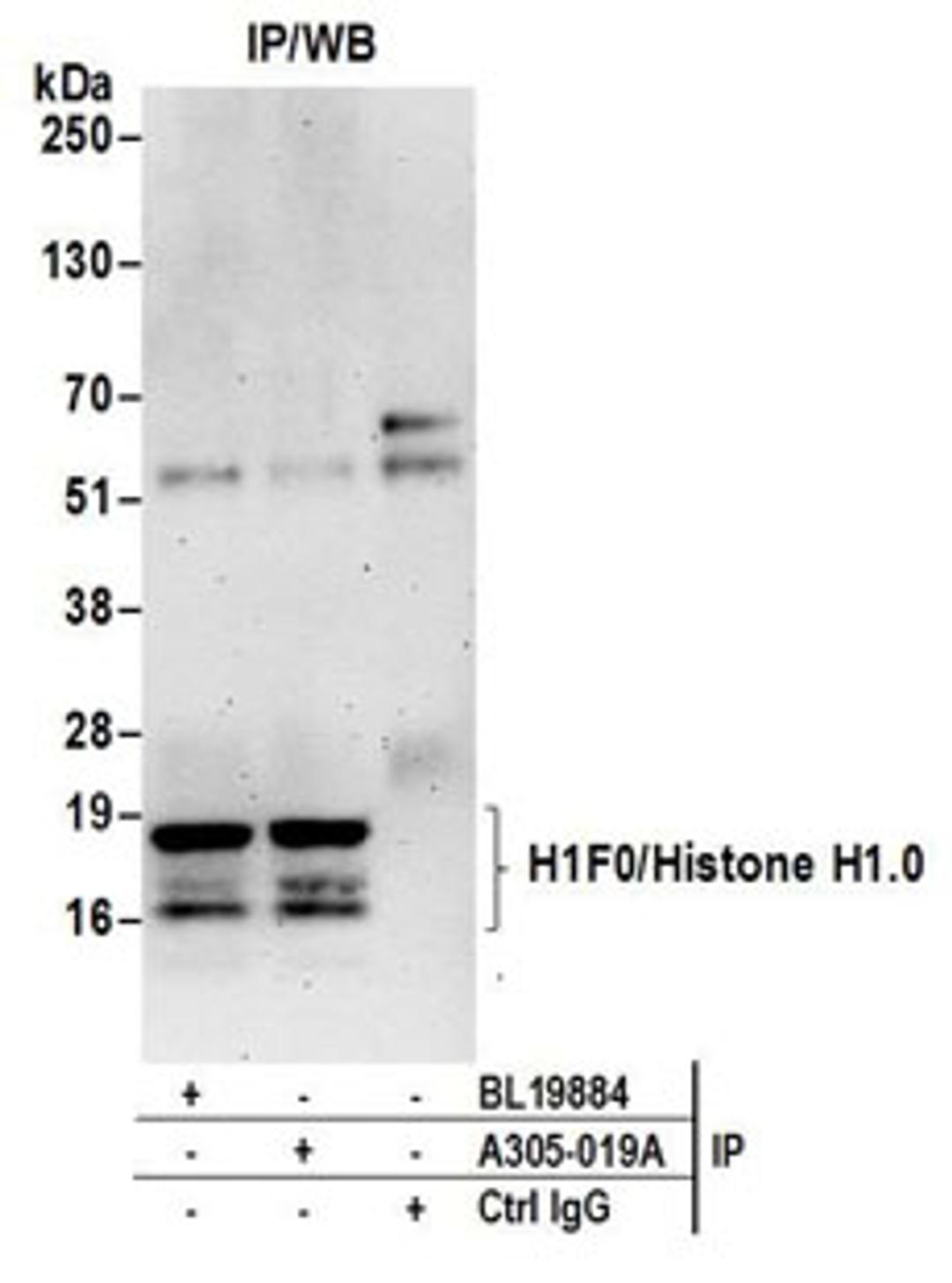 Detection of human H1F0/Histone H1 by western blot of immunoprecipitates.