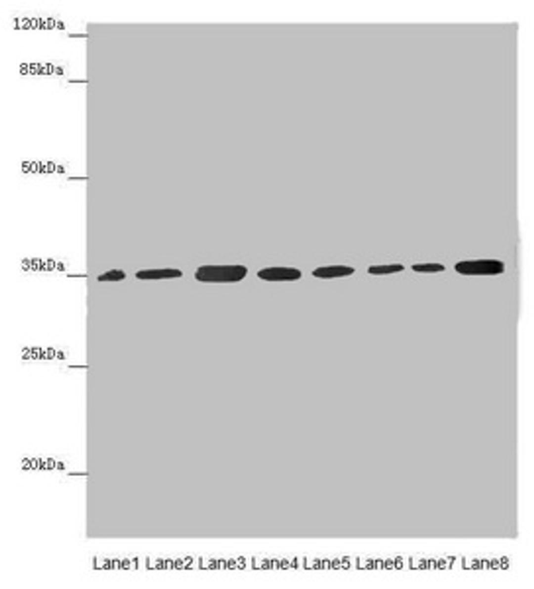 Western blot. All lanes: ETFA antibody at 2.88µg/ml. Lane 1: Mouse small intestine tissue. Lane 2: Mouse liver tissue. Lane 3: A431 whole cell lysate. Lane 4: Hela whole cell lysate. Lane 5: K562 whole cell lysate. Lane 6: A549 whole cell lysate. Lane 7: HepG2 whole cell lysate. Lane 8: MCF-7 whole cell lysate. Secondary. Goat polyclonal to rabbit IgG at 1/10000 dilution. Predicted band size: 36, 31 kDa. Observed band size: 36 kDa