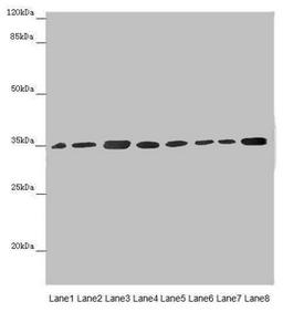 Western blot. All lanes: ETFA antibody at 2.88µg/ml. Lane 1: Mouse small intestine tissue. Lane 2: Mouse liver tissue. Lane 3: A431 whole cell lysate. Lane 4: Hela whole cell lysate. Lane 5: K562 whole cell lysate. Lane 6: A549 whole cell lysate. Lane 7: HepG2 whole cell lysate. Lane 8: MCF-7 whole cell lysate. Secondary. Goat polyclonal to rabbit IgG at 1/10000 dilution. Predicted band size: 36, 31 kDa. Observed band size: 36 kDa