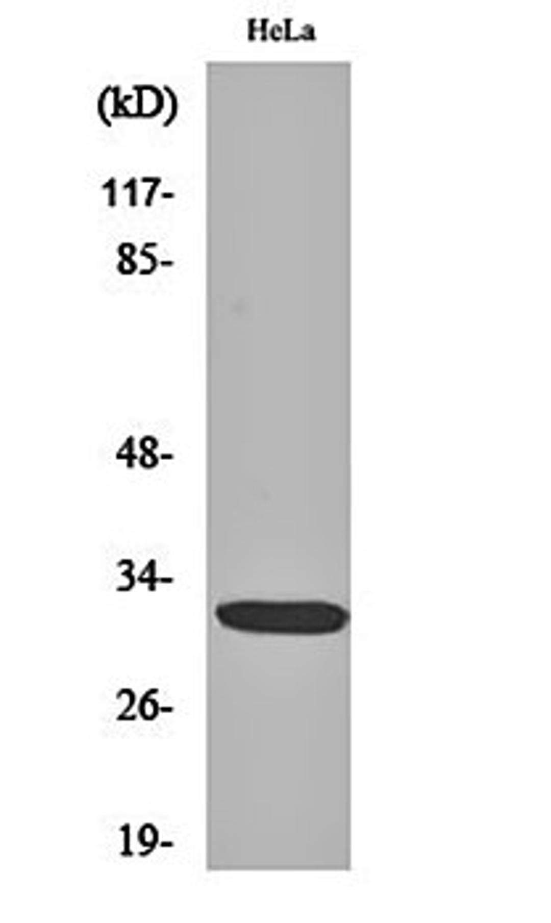 Western blot analysis of Hela cell lysates using Dlx-5 antibody