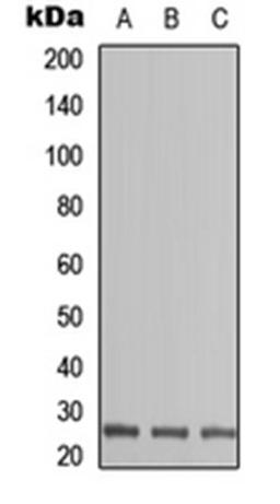 Western blot analysis of HEK293T (Lane 1), Raw264.7 (Lane 2), H9C2 (Lane 3) whole cell lysates using PS1D antibody