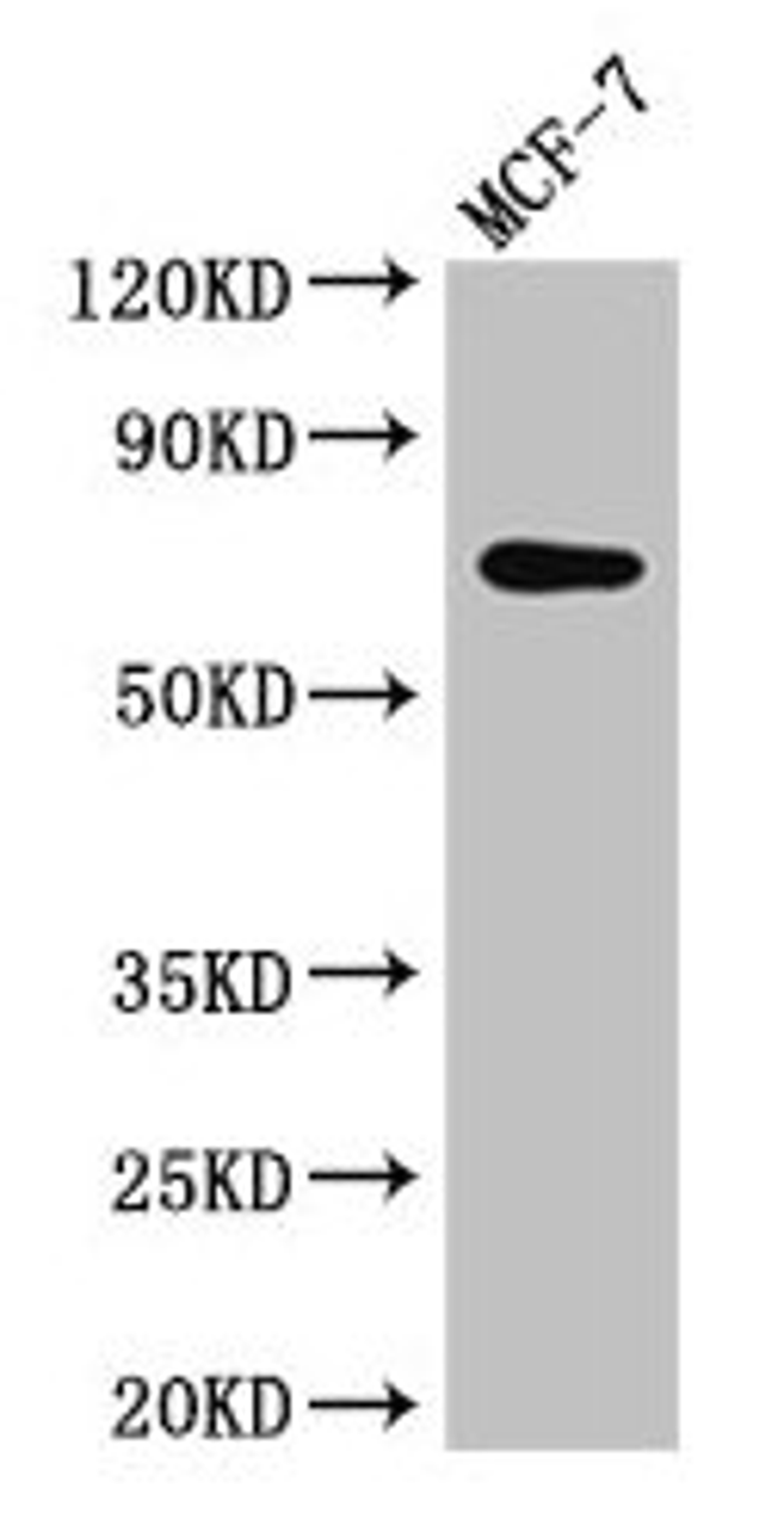 Western Blot. Positive WB detected in: MCF-7 whole cell lysate. All lanes: KARS antibody at 2.5µg/ml. Secondary. Goat polyclonal to rabbit IgG at 1/50000 dilution. Predicted band size: 69, 72 kDa. Observed band size: 69 kDa