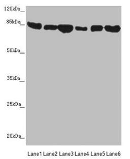 Western blot. All lanes: MFN1 antibody at 3.78µg/ml. Lane 1: Human placenta tissue. Lane 2: Mouse kidney tissue. Lane 3: NIH/3T3 whole cell lysate. Lane 4: Jurkat whole cell lysate. Lane 5: Hela whole cell lysate. Lane 6: K562 whole cell lysate. Secondary. Goat polyclonal to rabbit IgG at 1/10000 dilution. Predicted band size: 85, 42, 72 kDa. Observed band size: 85 kDa