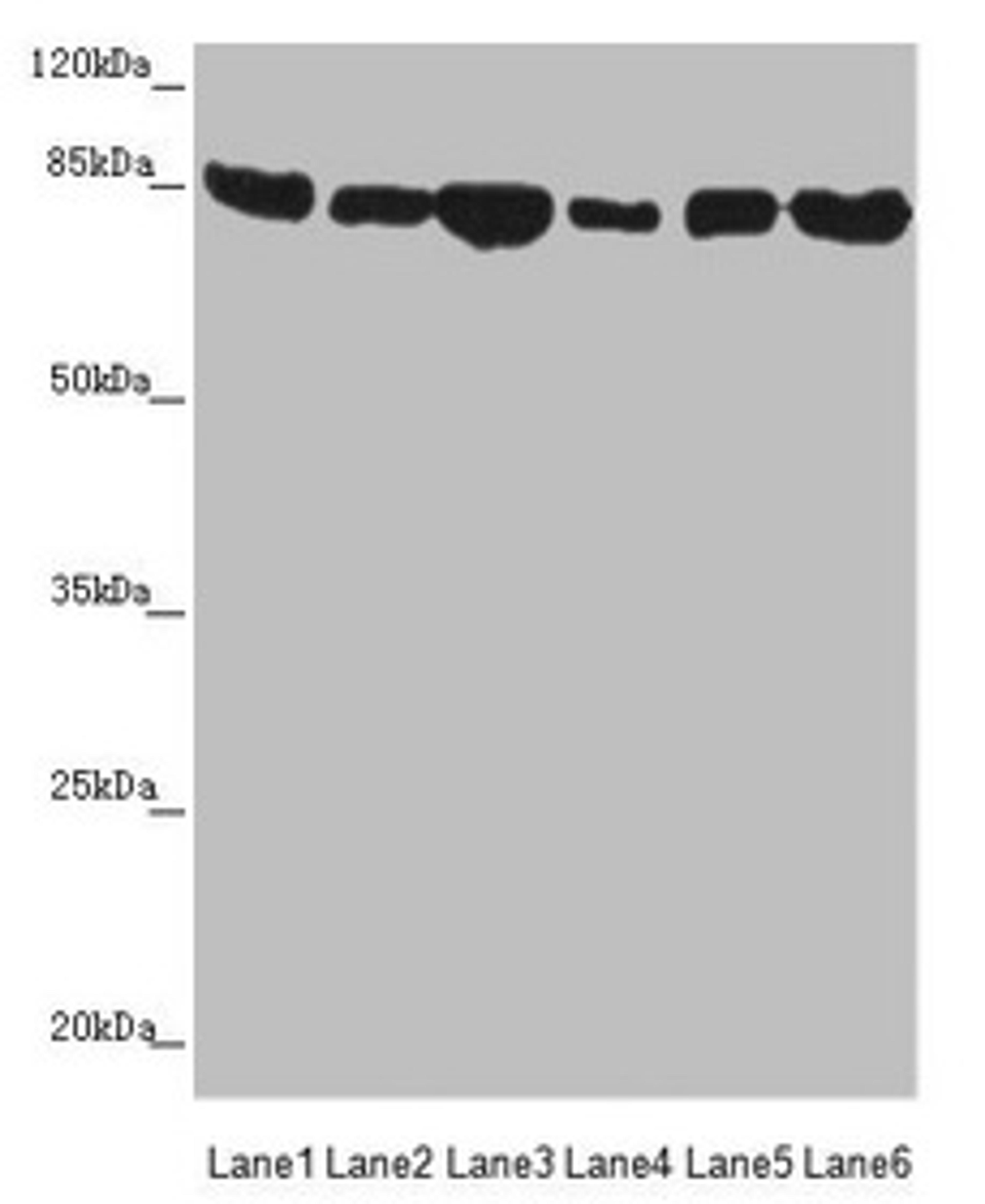 Western blot. All lanes: MFN1 antibody at 3.78µg/ml. Lane 1: Human placenta tissue. Lane 2: Mouse kidney tissue. Lane 3: NIH/3T3 whole cell lysate. Lane 4: Jurkat whole cell lysate. Lane 5: Hela whole cell lysate. Lane 6: K562 whole cell lysate. Secondary. Goat polyclonal to rabbit IgG at 1/10000 dilution. Predicted band size: 85, 42, 72 kDa. Observed band size: 85 kDa