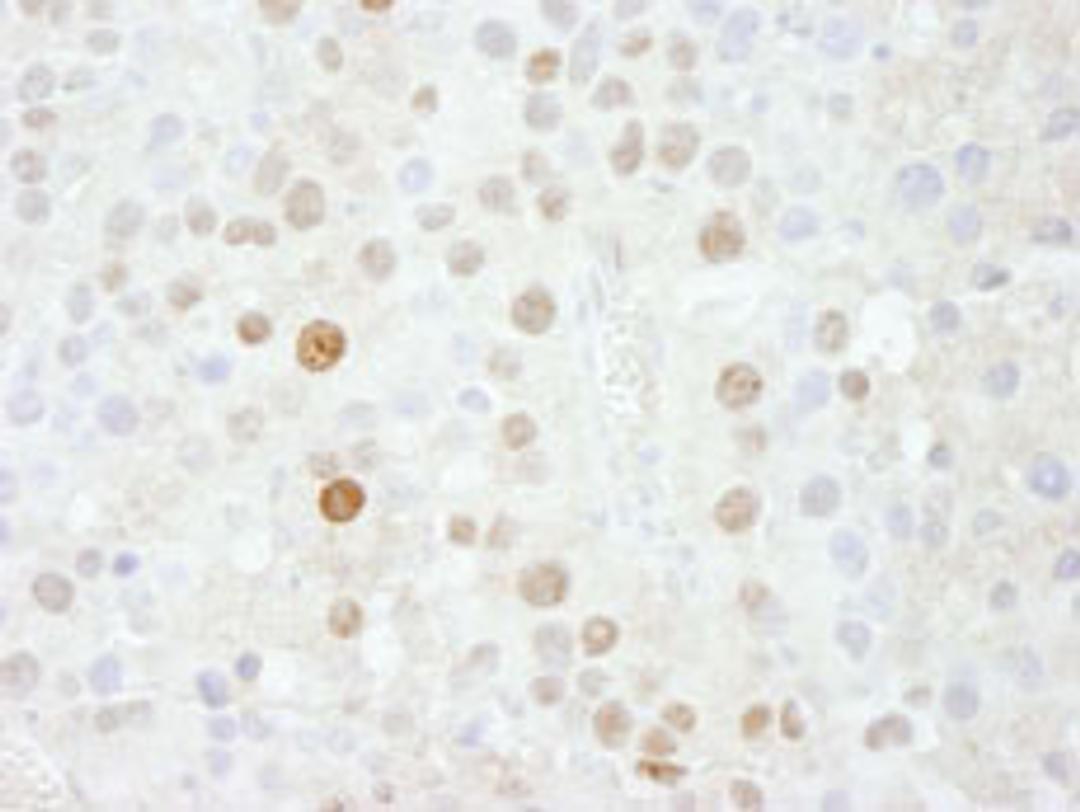 Detection of mouse FOXK1 by immunohistochemistry.