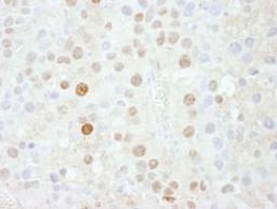 Detection of mouse FOXK1 by immunohistochemistry.